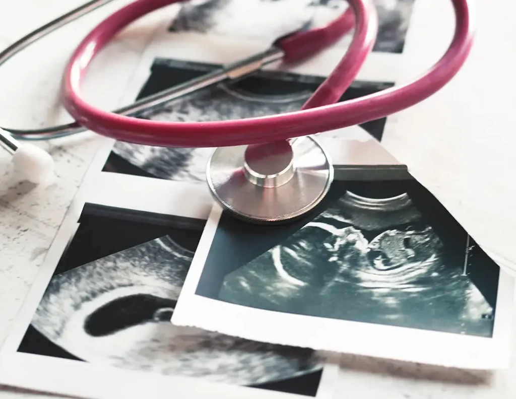 Diagnostic Ultrasound Services - pink stethoscope and ultrasound images of different stages of pregnancy - Salem, IL