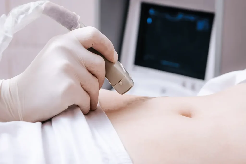 early ultrasound for pregnancy